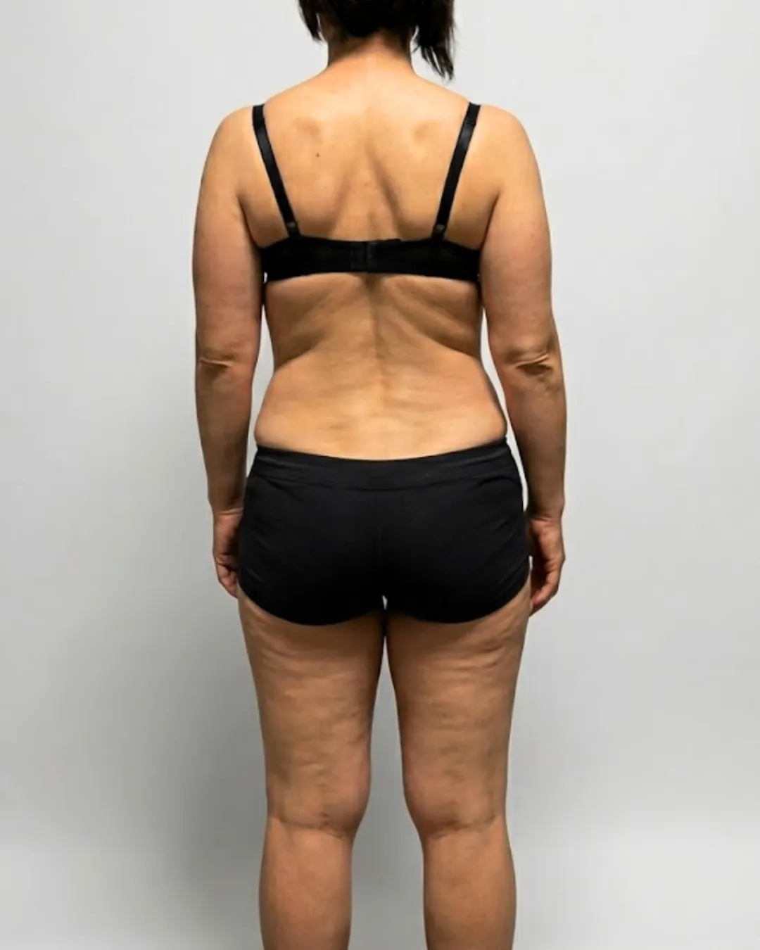 Female client before — starting point